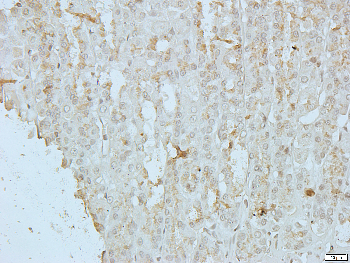 CD178 Rabbit Polyclonal Antibody