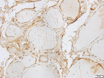 ARF6 Rabbit Polyclonal Antibody