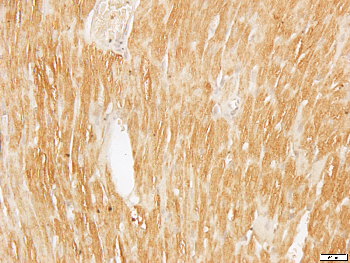 ARF6 Rabbit Polyclonal Antibody