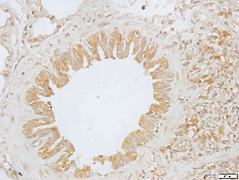 ARF6 Rabbit Polyclonal Antibody