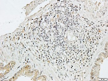 CDC2 Rabbit Polyclonal Antibody