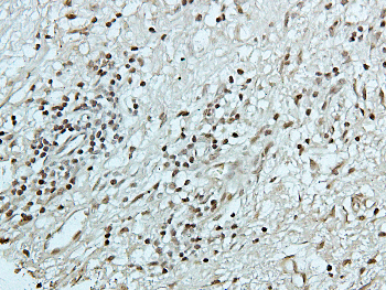 CDK1/2/3 (Phospho-T14) Rabbit Polyclonal Antibody