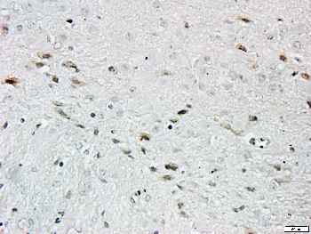 CNGA2 Rabbit Polyclonal Antibody