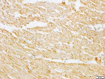 CNGA2 Rabbit Polyclonal Antibody