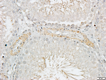 CNGA2 Rabbit Polyclonal Antibody