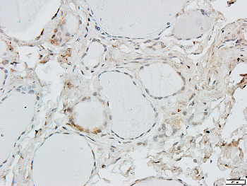 Collagen 6 alpha 2 Rabbit Polyclonal Antibody