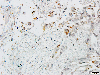 Collagen 6 alpha 2 Rabbit Polyclonal Antibody