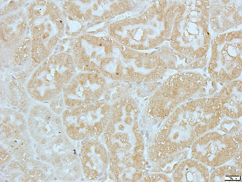 XPO2 Rabbit Polyclonal Antibody