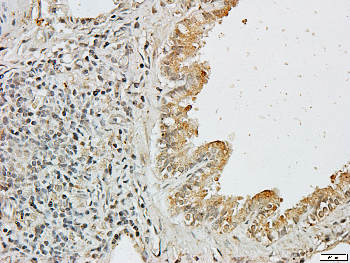 Catenin alpha 1/2 Rabbit Polyclonal Antibody