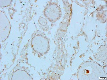 EIF4G2 Rabbit Polyclonal Antibody