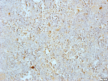 EIF4G2 Rabbit Polyclonal Antibody