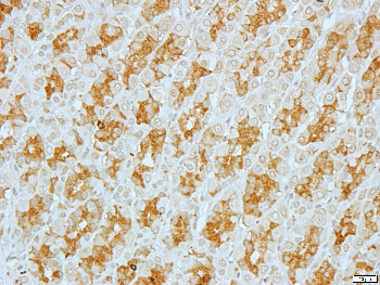EIF4G2 Rabbit Polyclonal Antibody