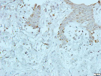 mTOR Rabbit Polyclonal Antibody