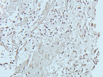 FYN (Phospho-Y530) Rabbit Polyclonal Antibody