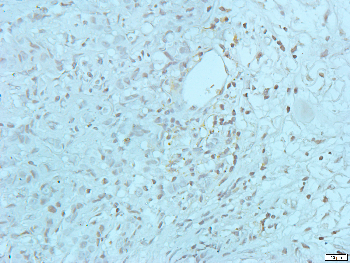 GLUR2 Rabbit Polyclonal Antibody