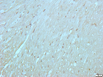 GLUR2 Rabbit Polyclonal Antibody