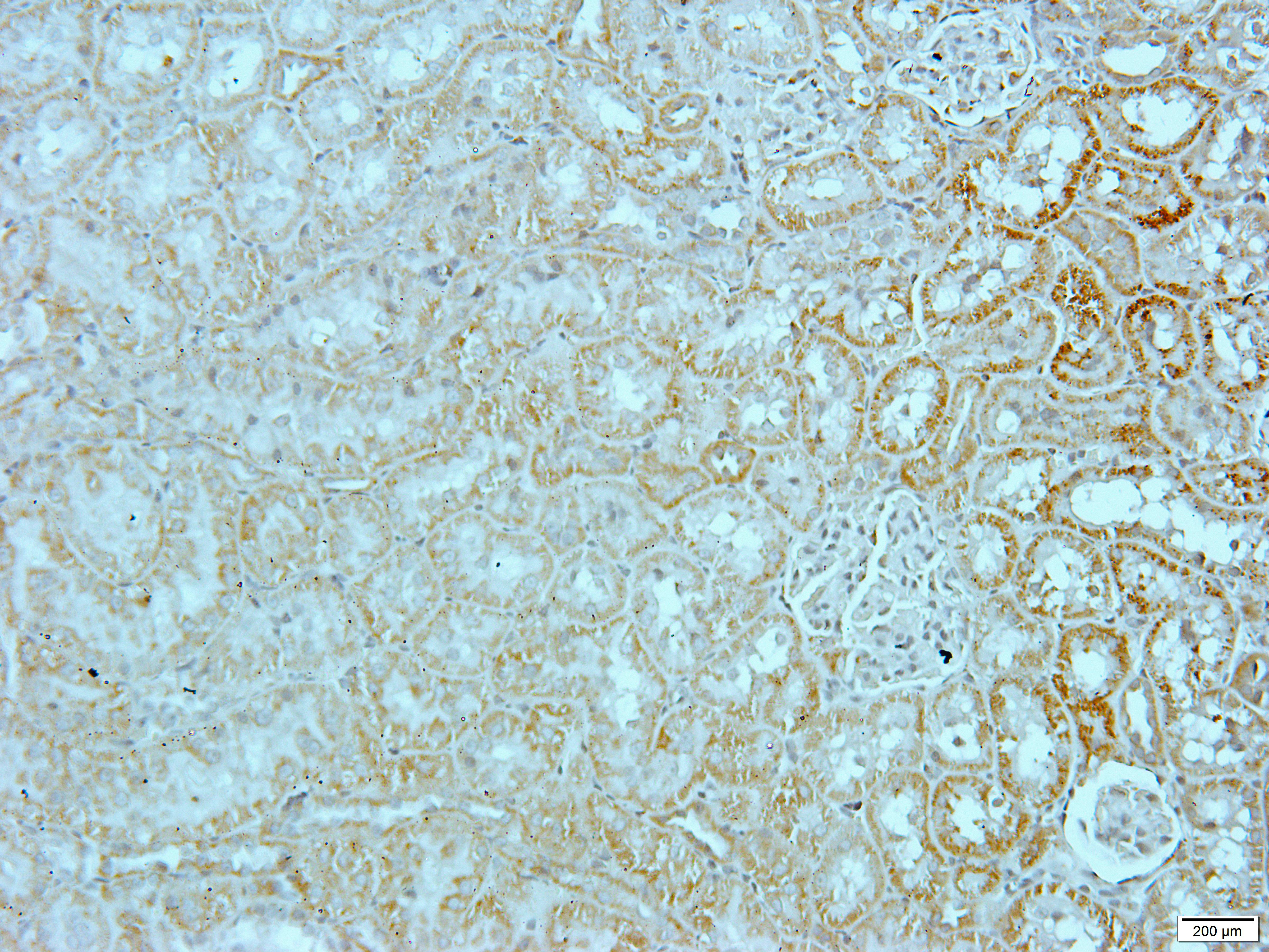 HSP60 Rabbit Polyclonal Antibody
