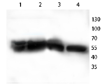 Cytokeratin 8 Rabbit Polyclonal Antibody