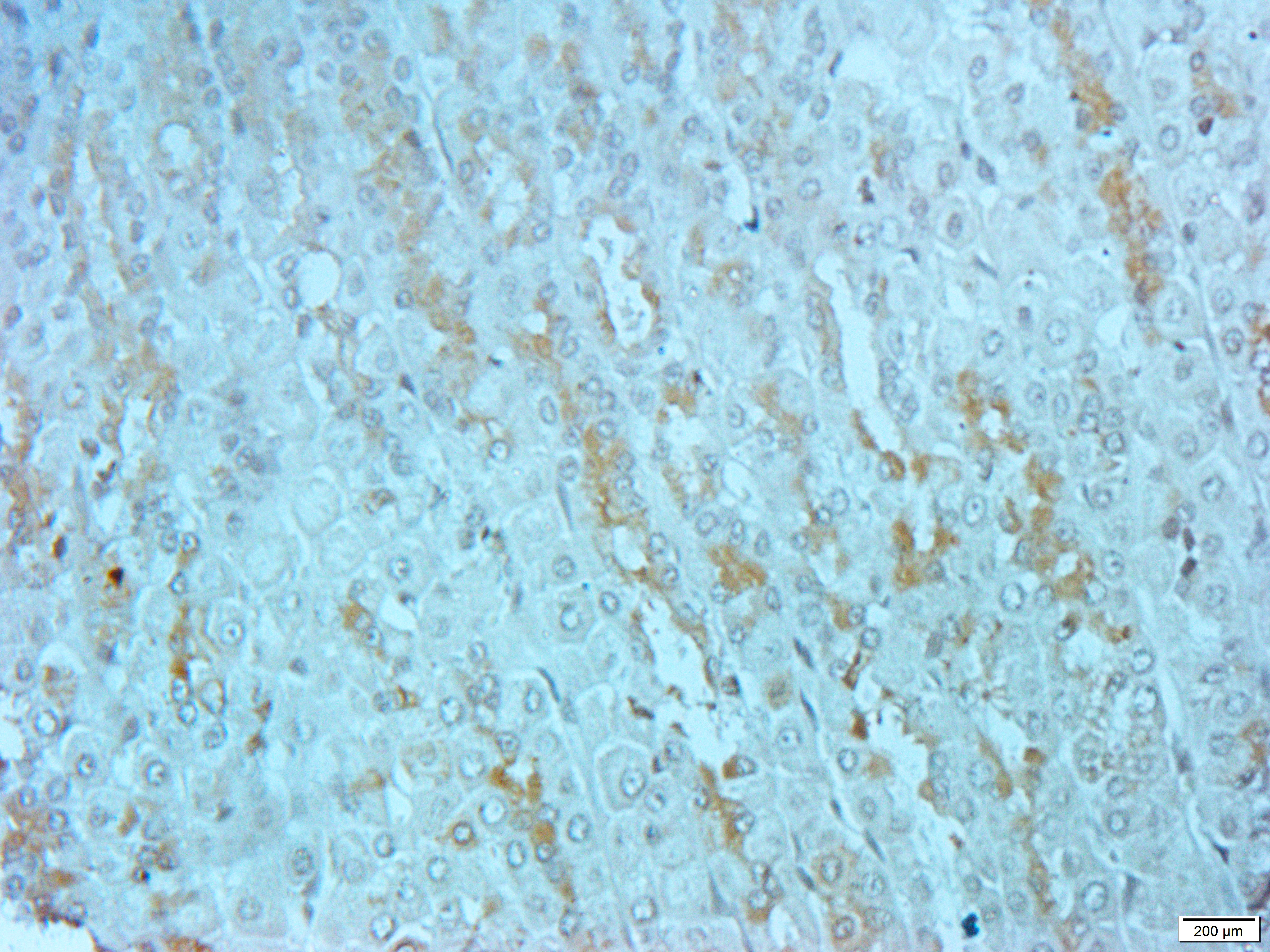 NFYA Rabbit Polyclonal Antibody