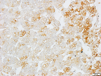 S100-A1 Rabbit Polyclonal Antibody