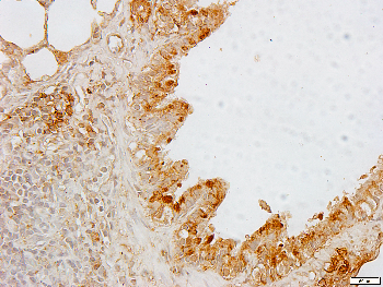 S100-A1 Rabbit Polyclonal Antibody