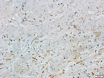 TIMP2 Rabbit Polyclonal Antibody