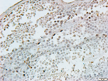 TIMP2 Rabbit Polyclonal Antibody