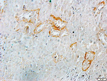 TIMP2 Rabbit Polyclonal Antibody