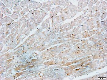 CDC37 Rabbit Polyclonal Antibody