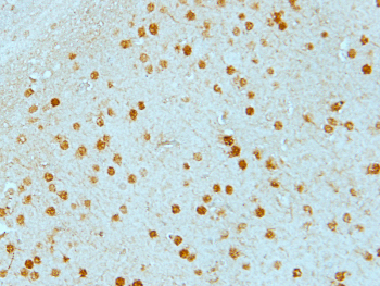CABC1 Rabbit Polyclonal Antibody