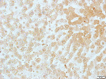 CABC1 Rabbit Polyclonal Antibody