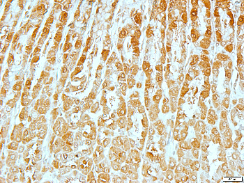 CABC1 Rabbit Polyclonal Antibody