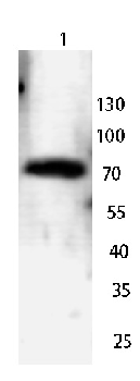 CABC1 Rabbit Polyclonal Antibody