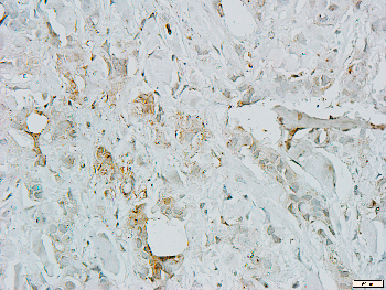 MARK3 Rabbit Polyclonal Antibody