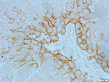 MARK3 Rabbit Polyclonal Antibody