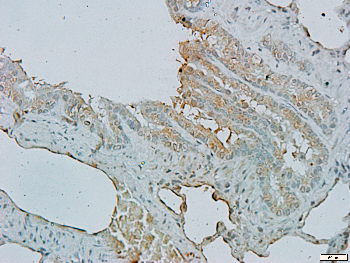 MARK3 Rabbit Polyclonal Antibody