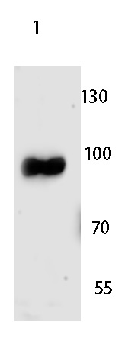 MARK3 Rabbit Polyclonal Antibody