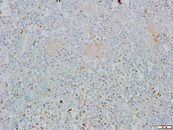 Alpha-adducin Rabbit Polyclonal Antibody