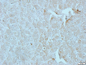 Alpha-adducin Rabbit Polyclonal Antibody