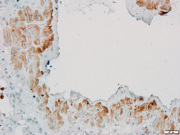 Alpha-adducin Rabbit Polyclonal Antibody