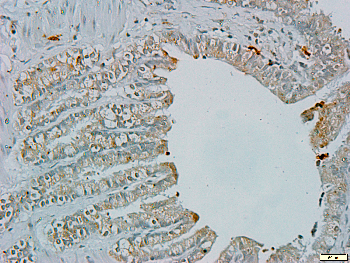 Alpha-adducin Rabbit Polyclonal Antibody