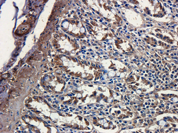 CCL5 Mouse Monoclonal Antibody