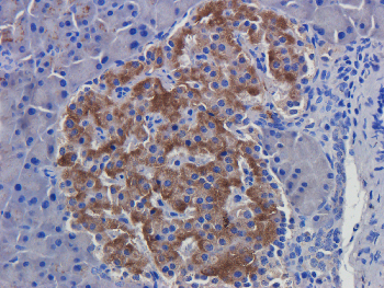 CCL5 Mouse Monoclonal Antibody