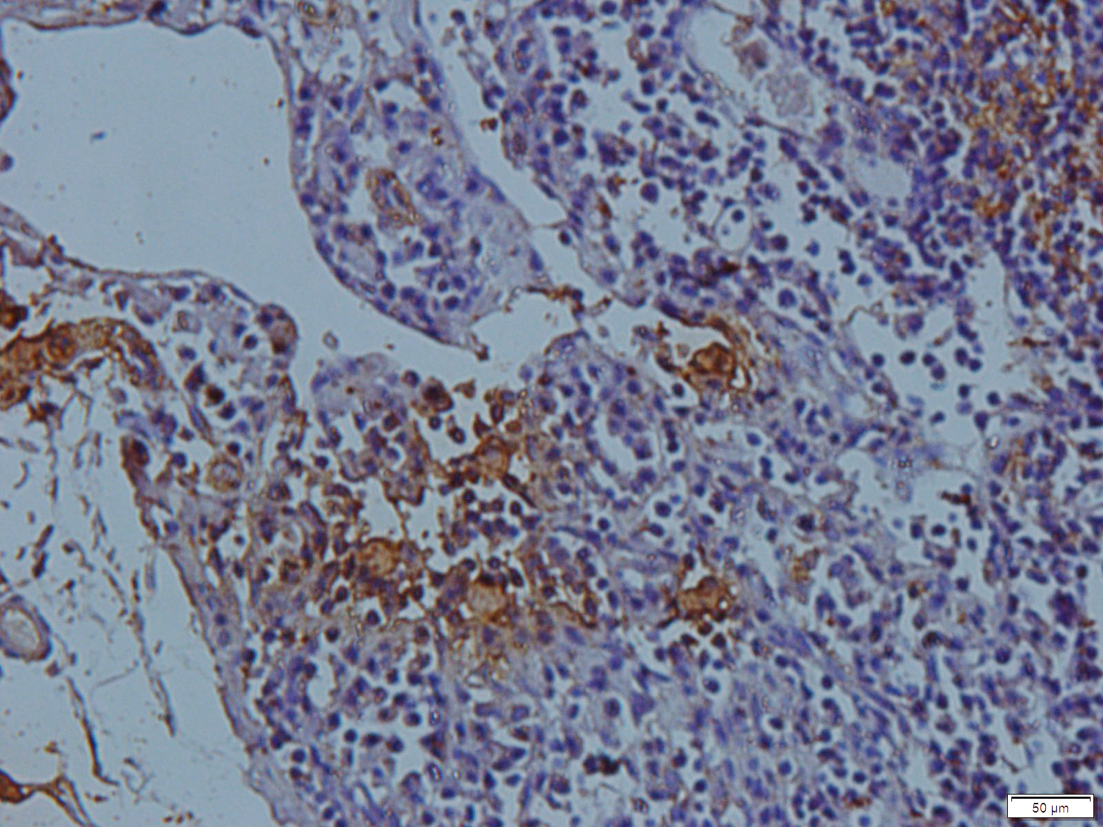 Cathepsin G Rabbit Polyclonal Antibody