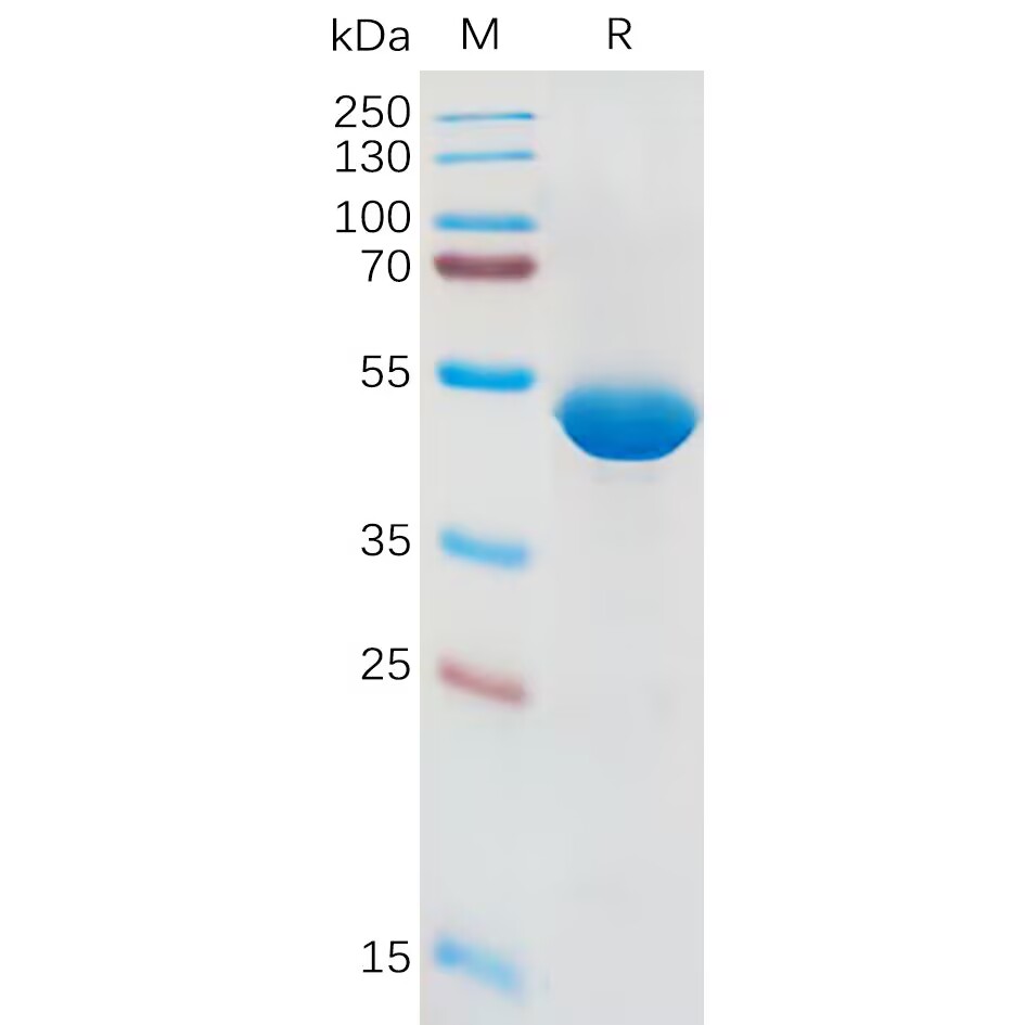 Recombinant Human IL1B Protein, hFc Tag