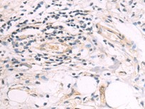 SEMA3G Antibody