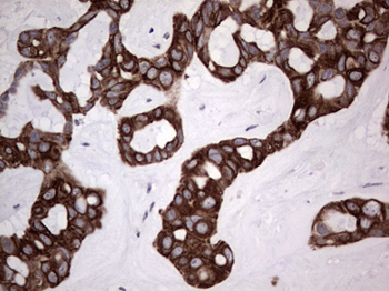 DBNL Antibody