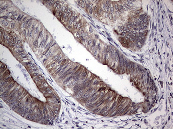 DBNL Antibody