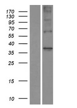 TAS2R44 (TAS2R31) Human Over-expression Lysate