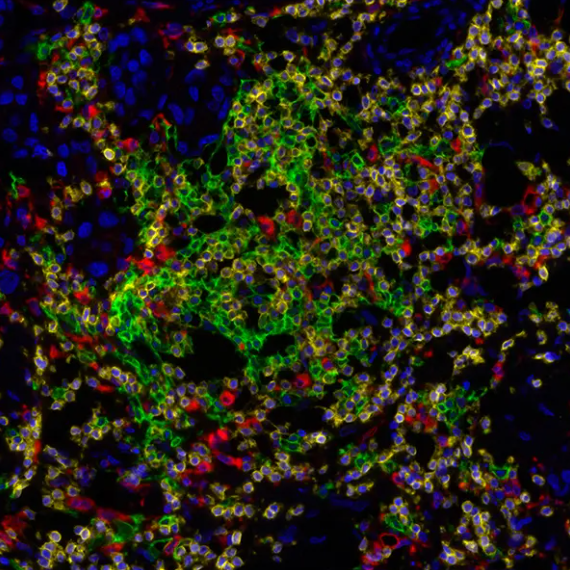 Immune Cell Localization Antibody Panel